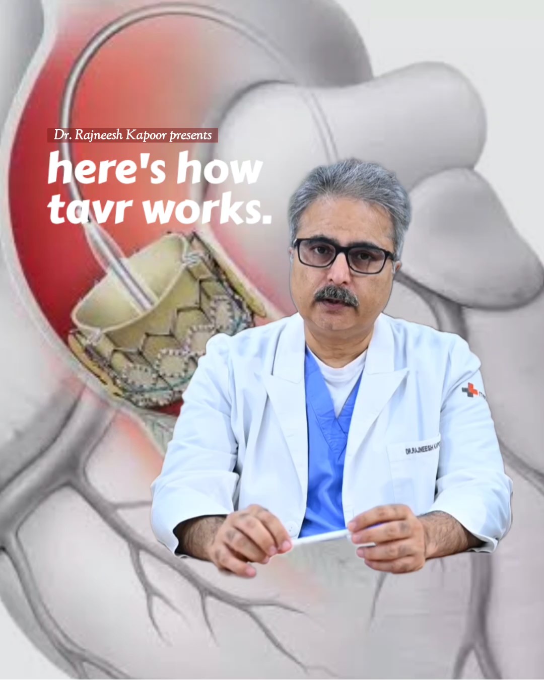 TAVR Explained: How Doctors Replace a Heart Valve Without Open Surgery